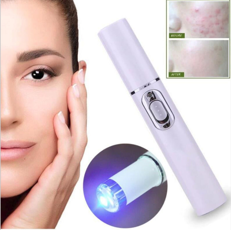 Blue Light Acne Laser Pen