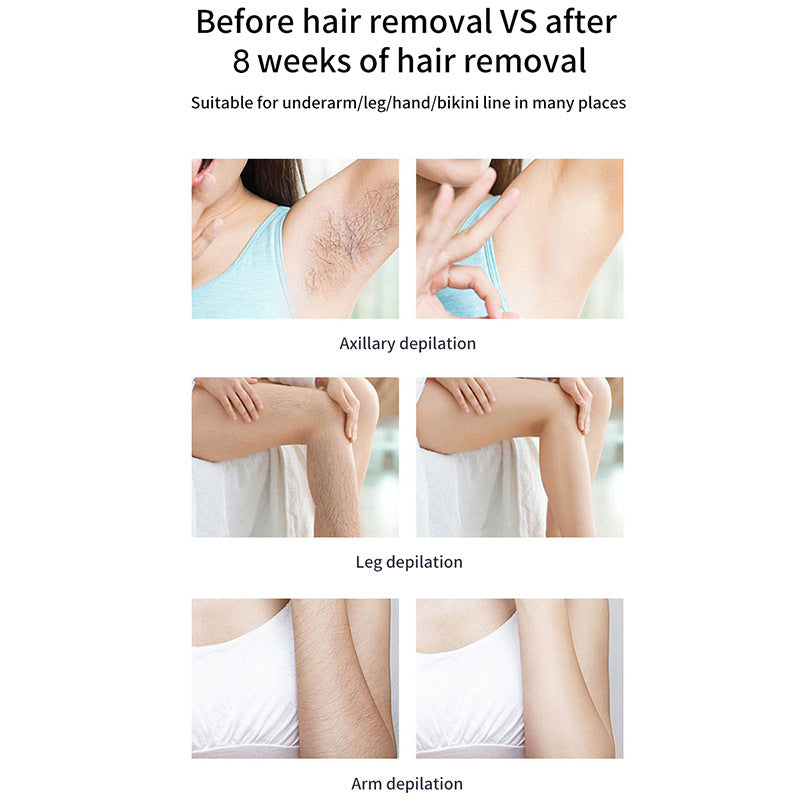 Ice Cooling IPL Hair Removal